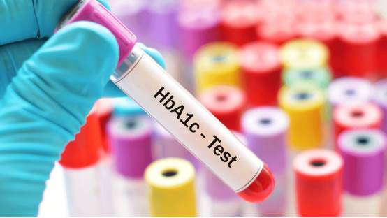 糖化ヘモグロビン（HbA1c）検査とは何ですか?