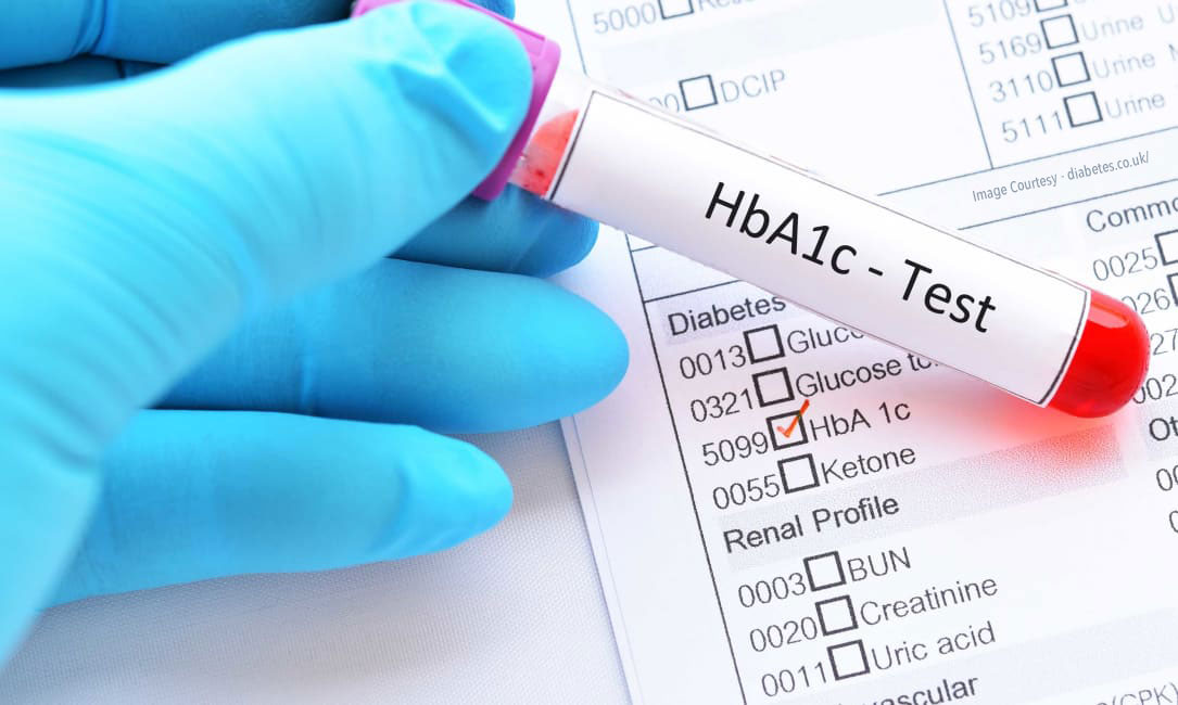 さまざまな集団に対する HbA1c 検査